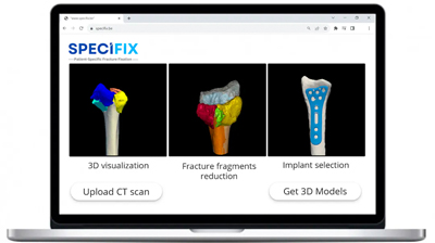 Specifix streamlines fracture treatment from preop planning to surgery. 