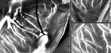 Hearts in motion: blood flow imaging