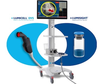 Lumicell DVS: imaging of tumors