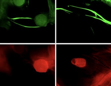 Visible difference: tissue types