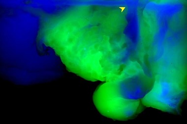 Clearer views: tissue imaging