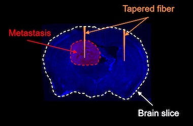 See the signs: NanoBRIGHT instrument