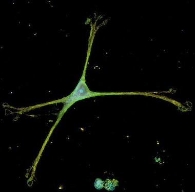 Seeing stars: astrocyte morphology