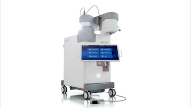 ViaLase glaucoma treatment