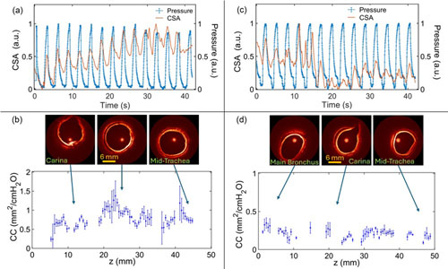 Accurate mapping of airway wall compliance along upper airway.