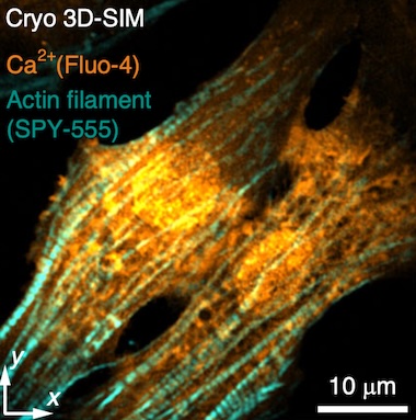 Arrested development: calcium ion wave