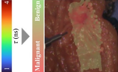 Tissue type: harnessing spectroscopic data