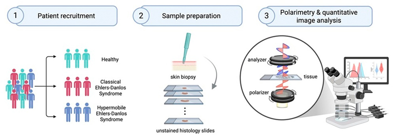 Label-free polarimetric analysis of EDS skin biopsies. Click for info.
