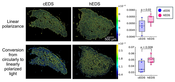 Representative polarization images to distinguish between cEDS and hEDS skin biopsies.