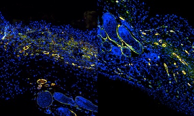 Rate of repair: hydrogel-treated wounds