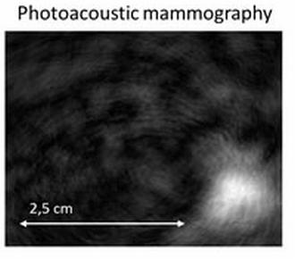 Photoacoustic scan