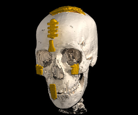 Yummy mummy: Skull image reconstructed as a hologram.