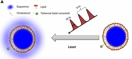 Laser-activated: Liposome encapsulating dopamine tethered to a gold nanoparticle.