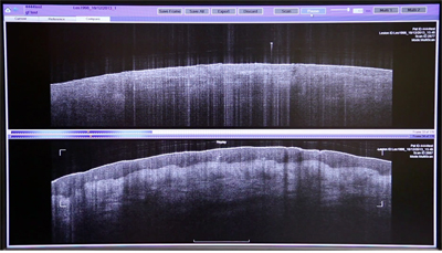 VivoSight is a tissue-imaging system that lets users see below the skin.