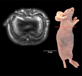 Marvellous mouse organs: photoacoustic imaging